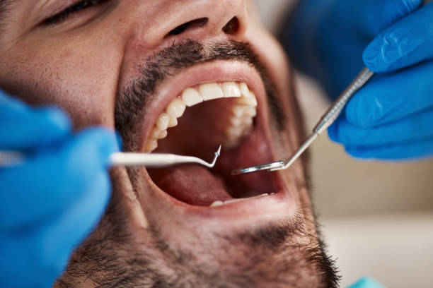 Best Walk-In Emergency Dentist in Grand Blanc, MI